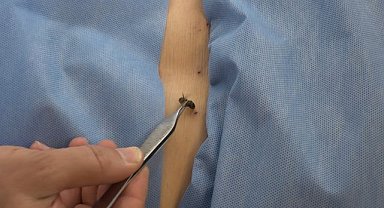 Bursa'da hastalar 'arı tedavisi' ile sağlığına kavuşuyor