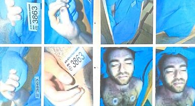 Cem Garipoğlu’nun bilirkişi raporundaki otopsi görüntüleri