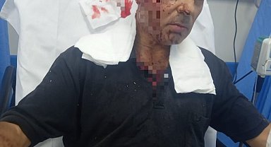 Bursa'da köpek dehşeti: Faciadan dönüldü