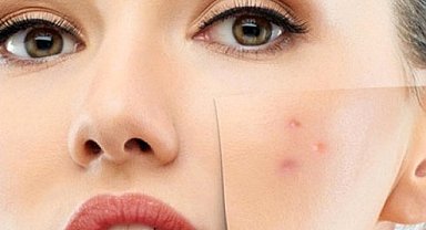 Cilt Lekelerine Elveda De! Doğal Yağların Mucizevi Gücü