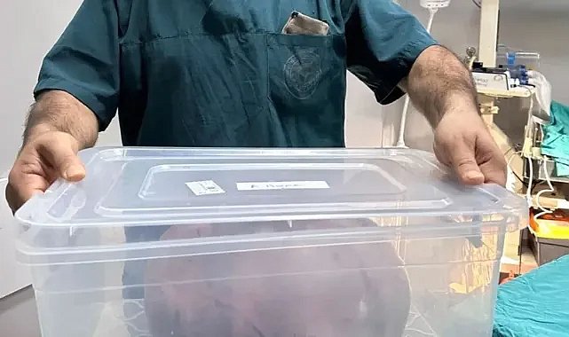 Trabzon'da yumurtalıklarından 9 kiloluk kitle çıktı
