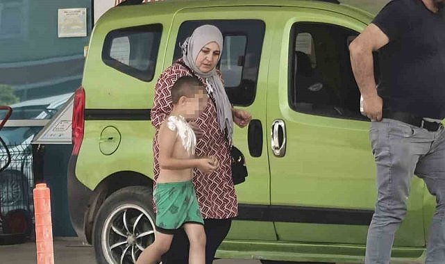 Üzerine parfüm sıkıp çakmak yakan çocuk yaralandı
