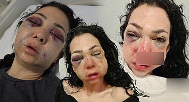 Anne ve oğlunu feci şekilde darp ettiler! Tanınmaz hale geldi!