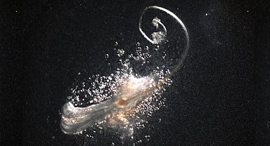 Saç dökülmesinde önemli gelişme: Laboratuvarda gerçek saç folikülleri üretildi!