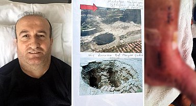 Tatili kabusa döndü! 2 metrelik çukura düştü!