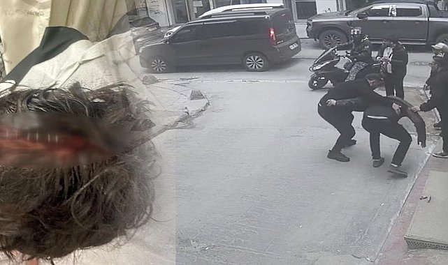 Yolda yürürken ölümden döndü: Kafasına 7 dikiş atıldı