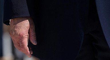 Trump'ın elindeki gizemli detay: Makyaj yapmış